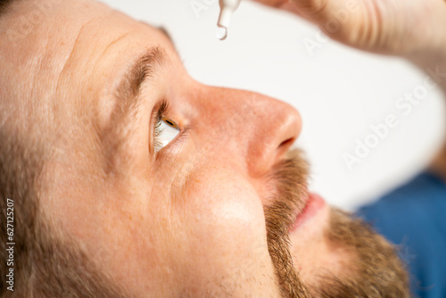 Fototapeta Naklejka Na Ścianę i Meble -  Young bearded Caucasian man applying eye drops in his eye 