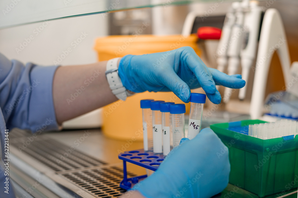laboratory medical tests and research analyses, hands in medical gloves hold test tubes with biomaterial laboratory medical tests and research analyses, hands in medical gloves hold test tubes with biomaterial