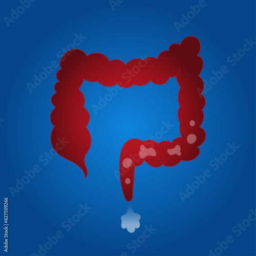 Medical cartoon of guts gases in vector illustration 