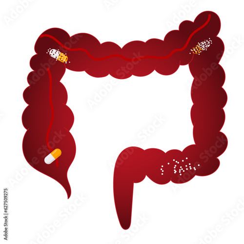 Medical cartoon of pills in gut splits in vector illustration 