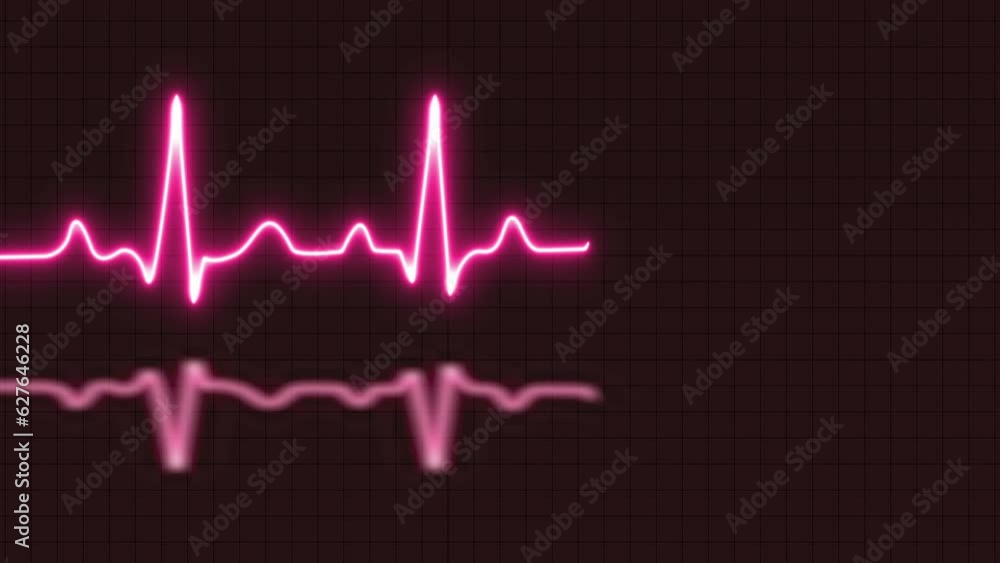 ECG or EKG graph, Cardiogram heartbeat heat pulse glowing red neon light loop animated background ECG or EKG graph, Cardiogram heartbeat heat pulse glowing red neon light loop animated background
