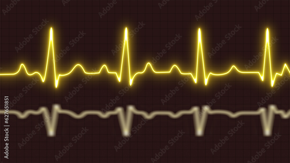Cardiogram cardiograph oscilloscope screen yellow. Glowing neon yellow