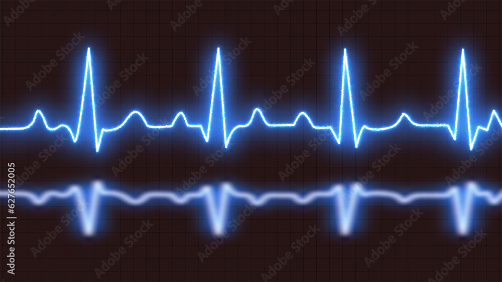 Blue bright neon heartbeat pulse rate graph on grid background