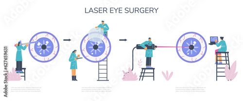 Eye laser surgery procedure infographic banner flat vector illustration.