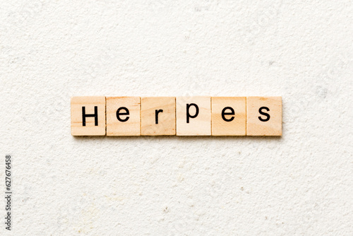 herpes word written on wood block. herpes text on table, concept