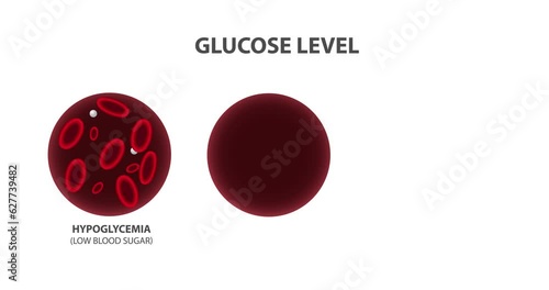 Blood glucose levels, medical animation 4K