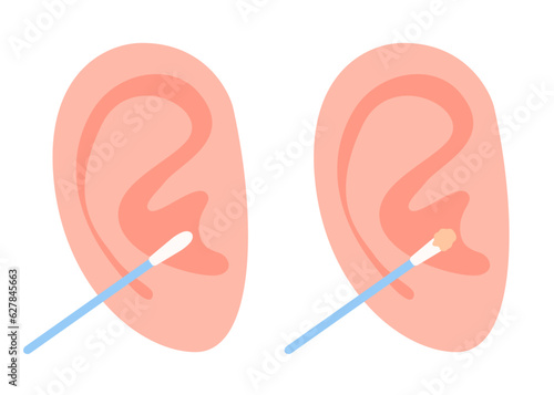 Ear stick for cleaning ear. Clean and dirty cotton swab. Hygiene and health care of cotton buds. Vector