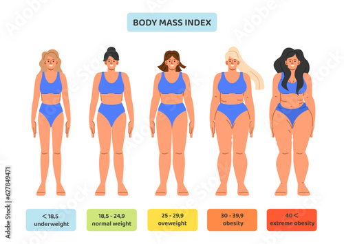 Set of body mass index concept. Medical infographics and educational materials. Underweight, overweight, obesity and normal weight. Cartoon flat vector collection isolated on white background