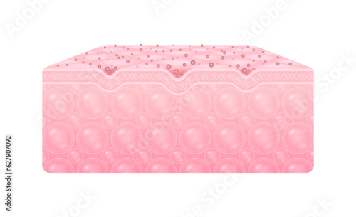 Dirt and ingrained the skin cell face clogging. The cause of acne and dermatitis. Isolated on white background. Realistic 3D Vector.