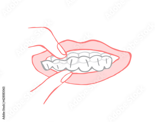 Orthodontic silicone trainer. Invisible braces retainer. Vector illustration
