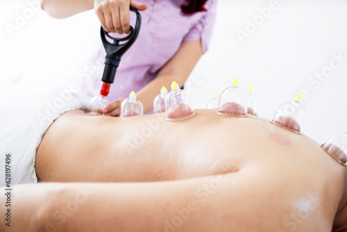 Performing hijama medical therapy with cups and vacuum pump on the patient to heal back pain.