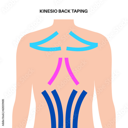 Kinesiology therapeutic tape
