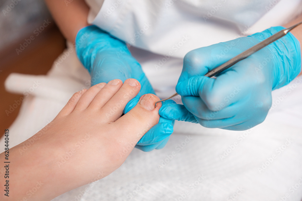 Chiropodist does a pedicure for the client's foot, cleaning the nails with a double-sided curette. Close up. The concept of salon professional nail care and podology Chiropodist does a pedicure for the client's foot, cleaning the nails with a double-sided curette. Close up. The concept of salon professional nail care and podology