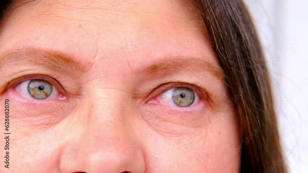 close up part of mature female face, woman 50-55 years old, tired eyes, allergies, deep wrinkles, age-related skin changes, wrinkles around eyes, overhang, concept of cosmetic anti-aging procedures close up part of mature female face, woman 50-55 years old, tired eyes, allergies, deep wrinkles, age-related skin changes, wrinkles around eyes, overhang, concept of cosmetic anti-aging procedures
