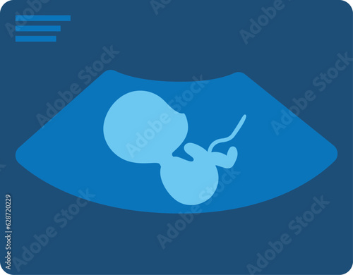 Ultrasound of baby with umbilical cord.