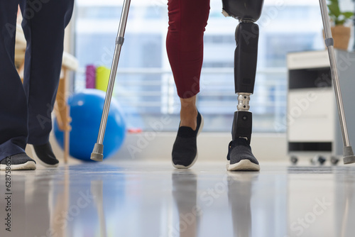 Midsection of caucasian physiotherapist and senior woman with artificial leg walking with crutches