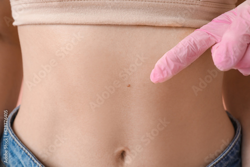 Dermatologist examining you...