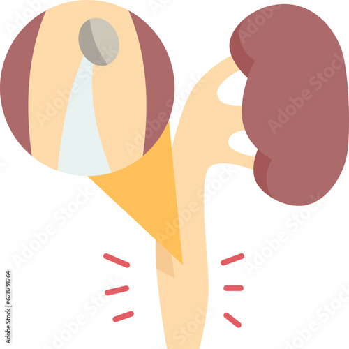 ureteroscopy  icon
