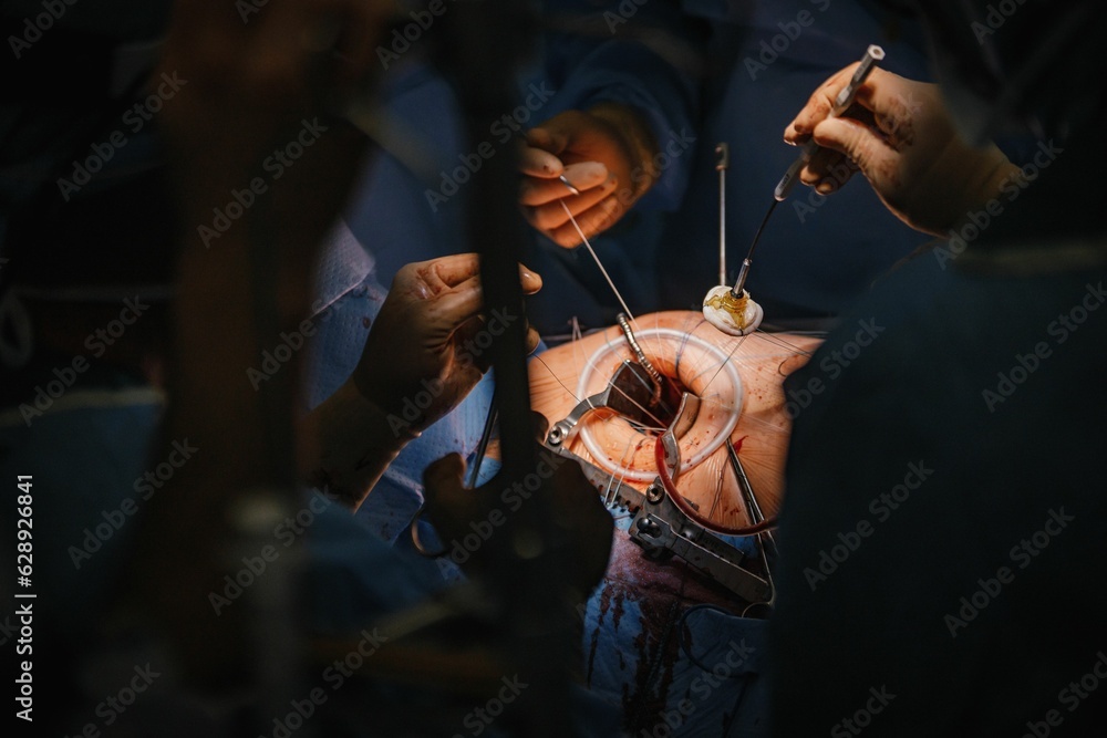 Fototapeta premium Team of medical professionals performing surgery on a patient.