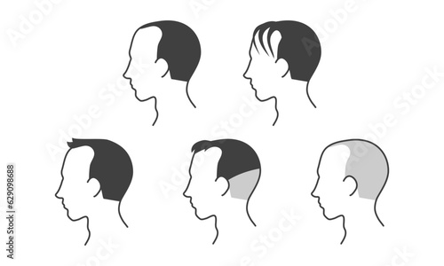 生え際が薄い男性のヘアスタイル線画イラスト
