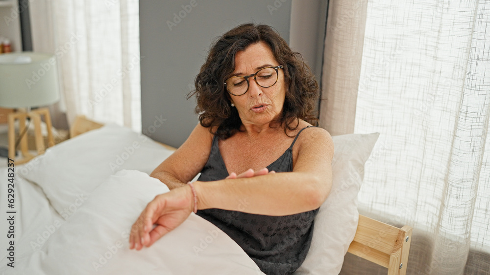 Middle age hispanic woman scratching arm for itchy at bedroom Middle age hispanic woman scratching arm for itchy at bedroom