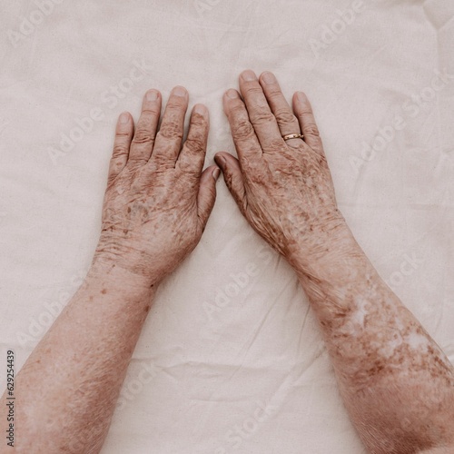 Elderly woman's hands are seen resting on a white surface, her wrinkled and aged skin in full view