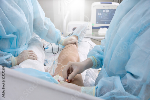 Surgical treatment varicose veins in hospital by team vascular surgeons by Radiofrequency ablation. Surgeon in operating room inserts catheter into vein on patient's lower limb treat varicose veins photo