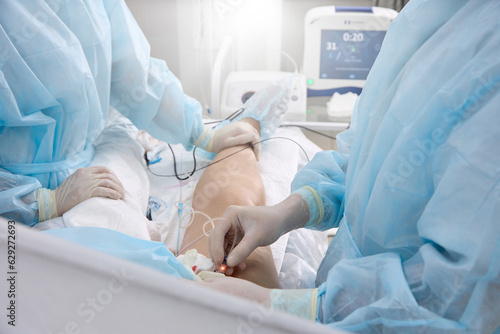 Surgical treatment varicose veins in hospital by team vascular surgeons by Radiofrequency ablation. Surgeon in operating room inserts catheter into vein on patient's lower limb treat varicose veins