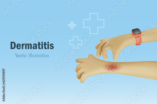 Dermatitis, allergy and medical skin problem. Hand scratching on itchy arm. Medical and health care. 3D vector cartoon character.
