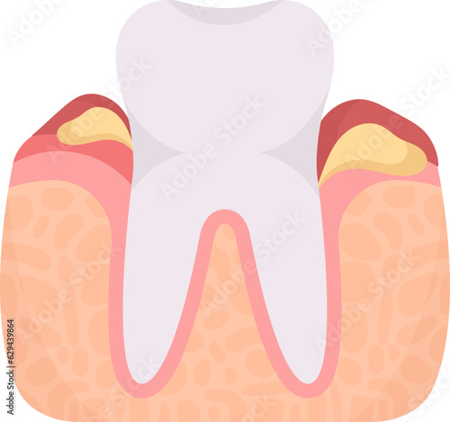Dental Flux Tooth Problem