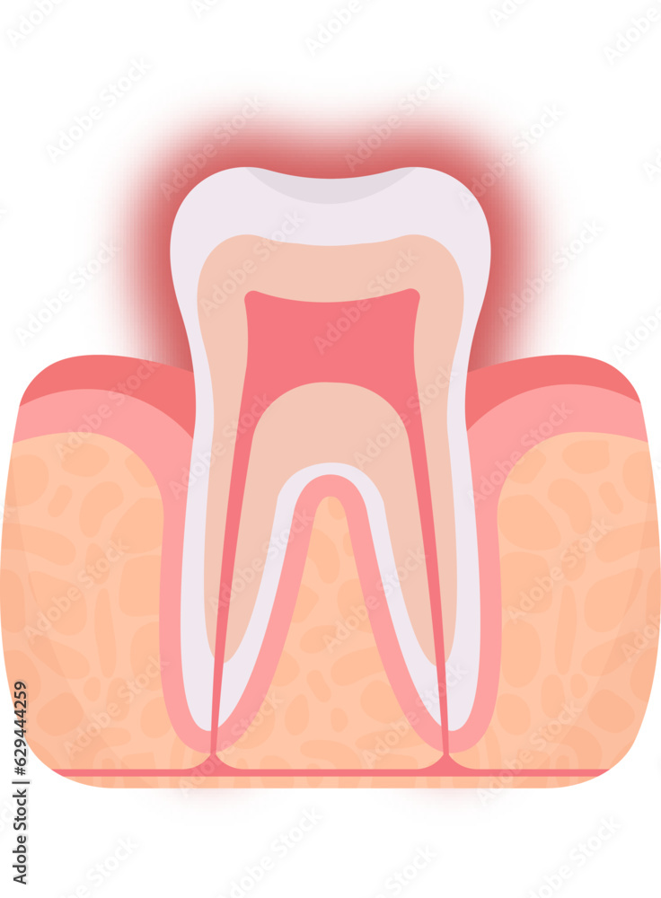 Sensitive Tooth Problem