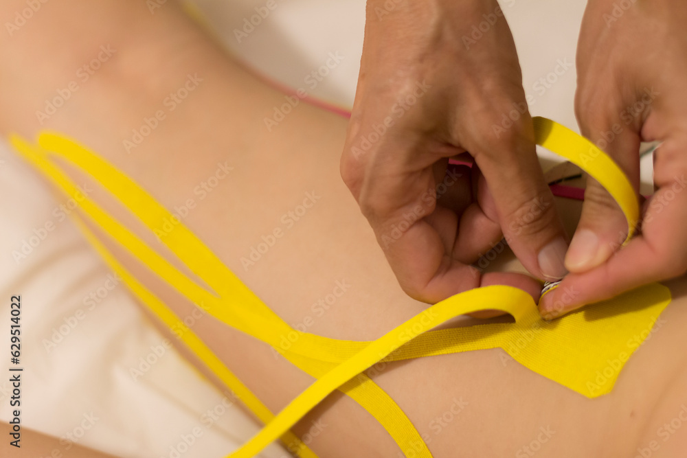 Holistic medicine and treatment with elastics soaked in medical substances on a young woman's legs.