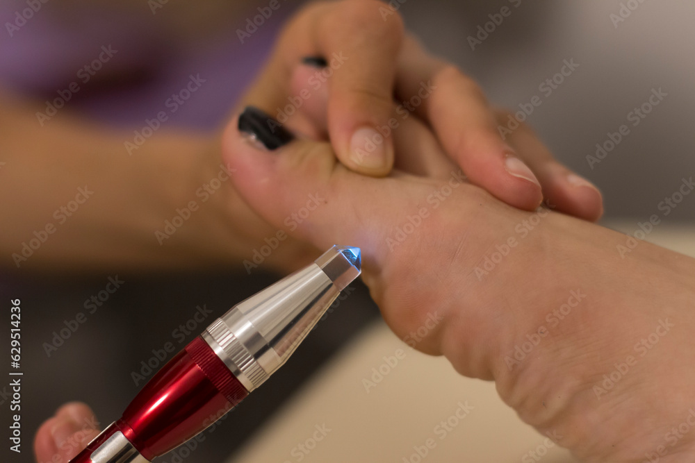 Holistic medicine and acupuncture concept: detail of a foot treatment with pulsed light. Holistic medicine and acupuncture concept: detail of a foot treatment with pulsed light.