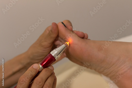 Holistic medicine and acupuncture concept: detail of a foot treatment with pulsed light.
