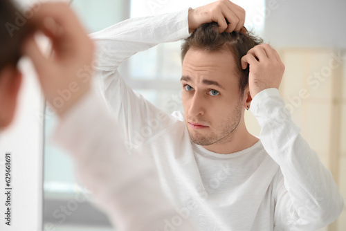Young man with hair loss pr...