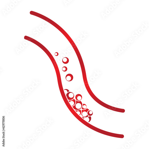 vector of cholesterol plaque