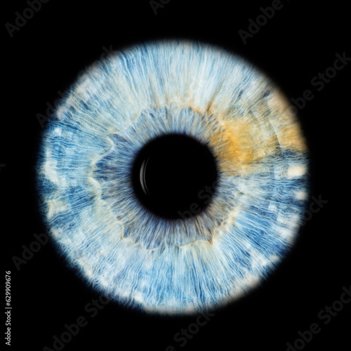 IRIS EWP