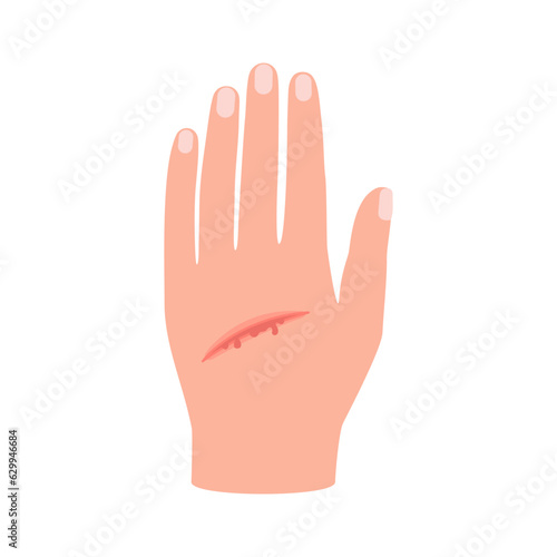 Wound of hand human skin, scratch. Cut injury skin, bleeding cut. Vector
