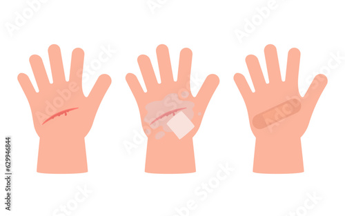 Wound of hand kid skin, scratch. First aid for cut injury skin, bleeding cut. Clean and disinfection wound, patch for safe health. Vector