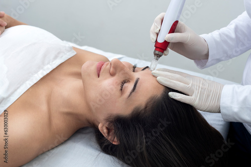 cosmetology treatment with dermapen technique for the care and beauty of the skin and health photo