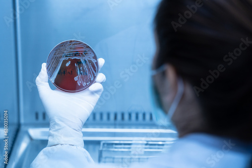 Scientist hand wearing white gloves hold agar plate for diagnosis bacterial or  microorganism at laboratory. Selective petri dish with colonies of bacteria photo