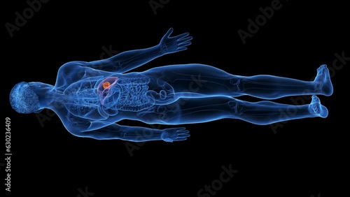 Animation of a malignant tumor in a man's liver photo