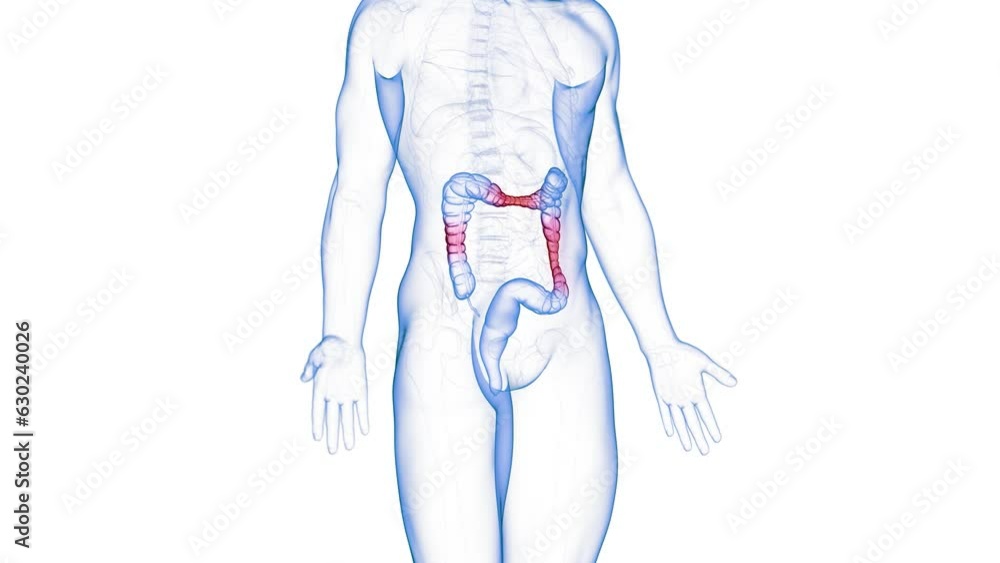 Animation of colon affected by inflammatory bowel disease Animation of colon affected by inflammatory bowel disease