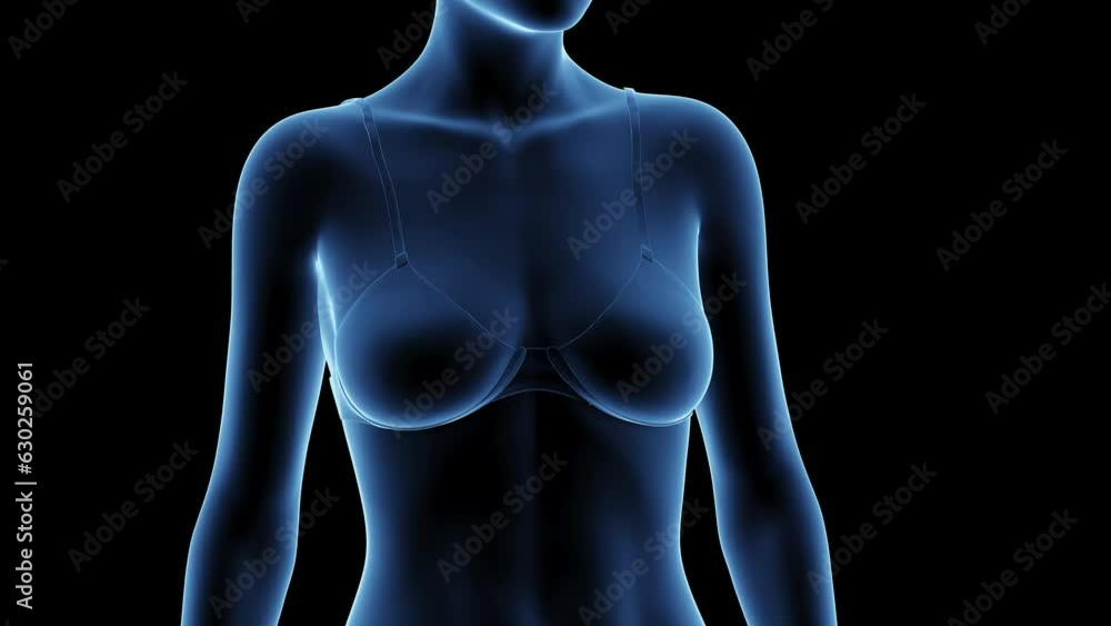 Animation of a woman after breast enhancement Animation of a woman after breast enhancement