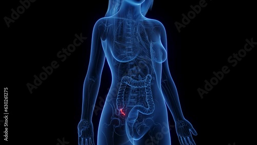 Animation of the appendix of a woman photo