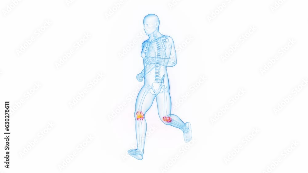 Animation of a man having knee pain while jogging Animation of a man having knee pain while jogging