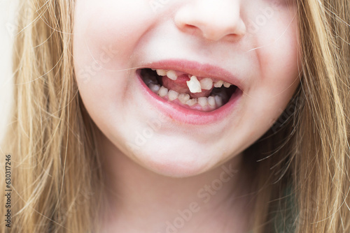 portrait of a little child girl moving her milk front tooth with her tongue in open mouth.