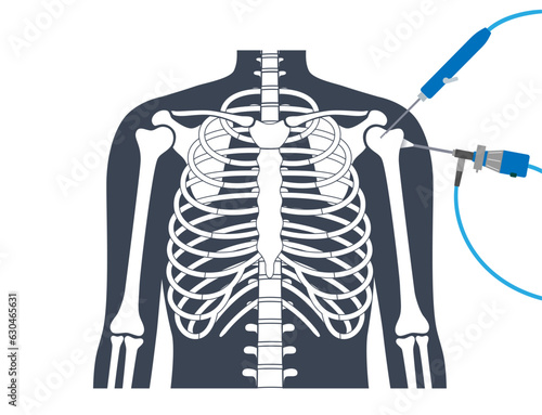 Shoulder arthroscopy poster