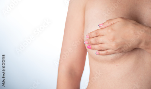 Breast cancer disease concept. a caucasian woman preparing for mastectomy operation - female cancer. World day against breast cancer. October 19.