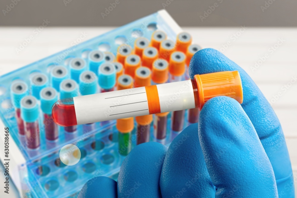 Biochemist or Technologist holds sample of blood Biochemist or Technologist holds sample of blood